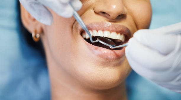 Best Emergency Wisdom Teeth Removal in Fairfax, MN